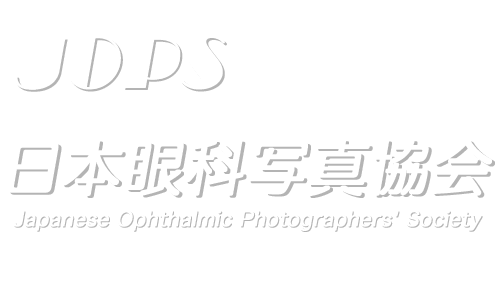 JOPS 日本眼科写真協会